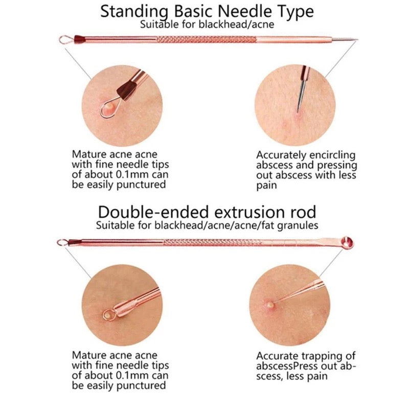 Pimple Popper Set
